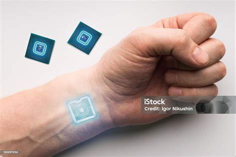 rfid-chip handy|rfid chip hand implant.